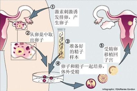 高齡二胎